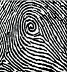 ulnar peacock eye